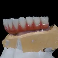 hibridas de peek atornilladas con resina